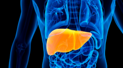 Fatty Liver Disease