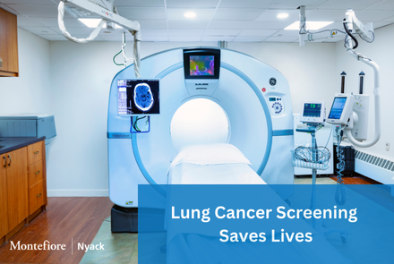 Lung Cancer Screening Saves Lives