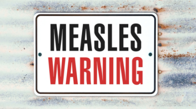 Measles - What You Should Know